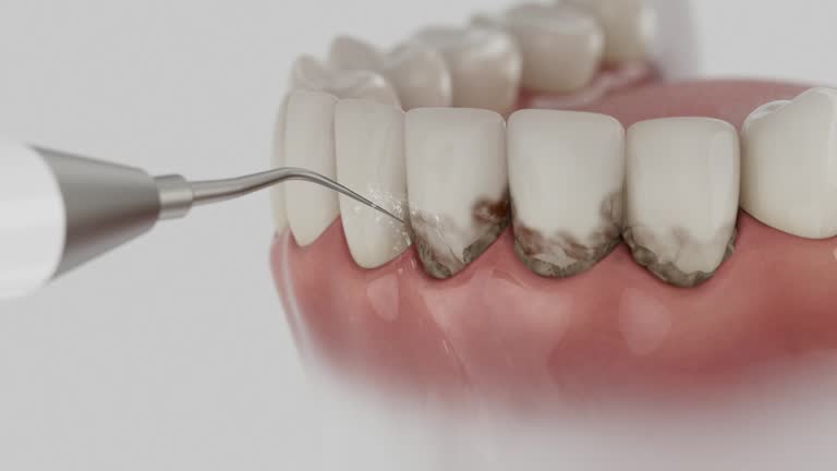 Reliable Dental Implants contractor in Kennett, MO by Smile Center Dentistry